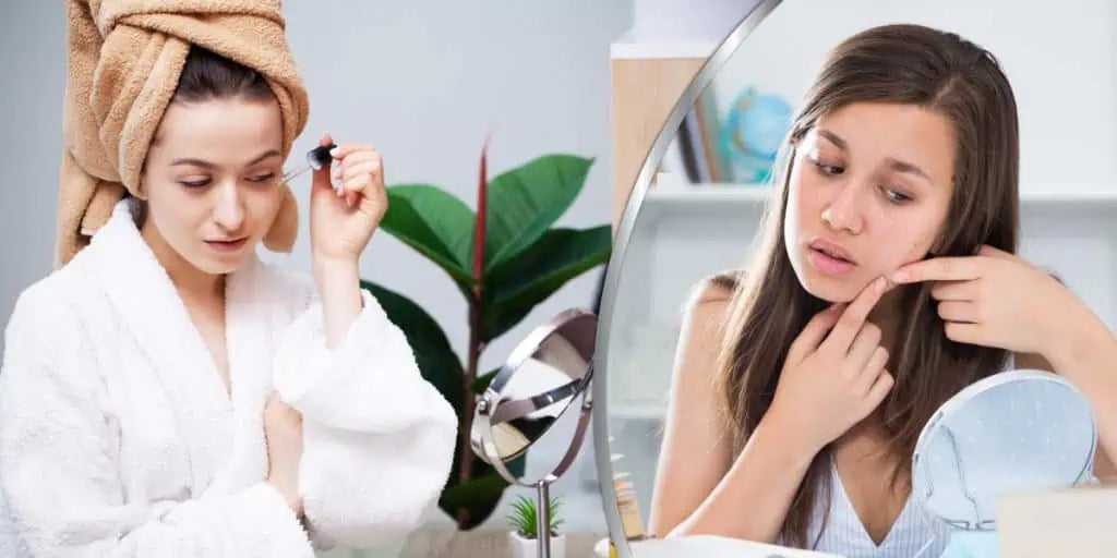 Dry Skin SOS: How to Replenish with Elmore’s Deep Hydrators