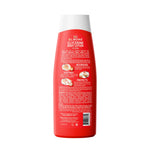 Soothing Body Lotion for Itchy Skin – Chamomile Extract by Elmore