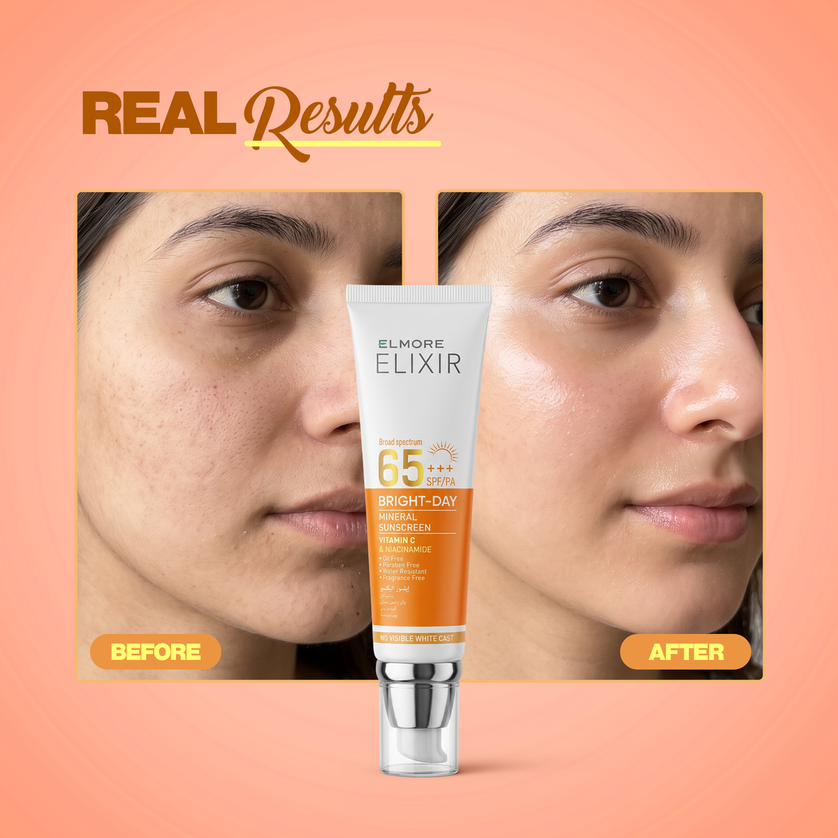 Elmore ELIXIR Sunscreen SPF 65