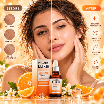 Before and after for 