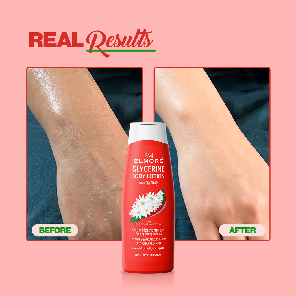 Elmore Glycerine Chamomile Body Lotion — Before and after artwork